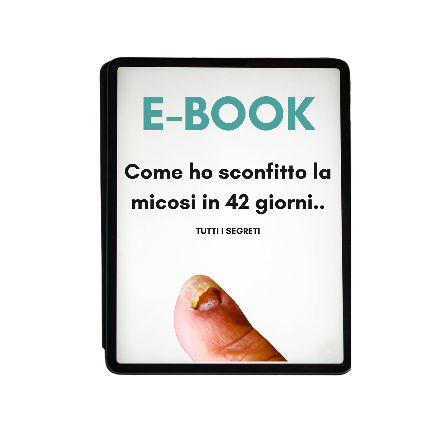 Ebook Protocollo Anti-Micosi