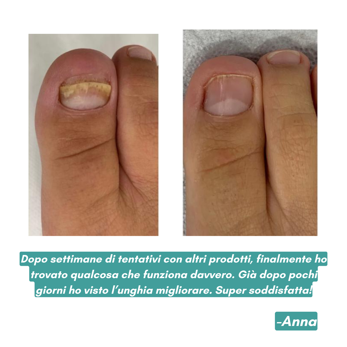 Apparecchio Anti micosi DermaGlide